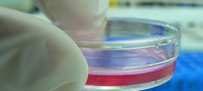 IVF is the right option