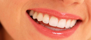 Dental implants v bridges